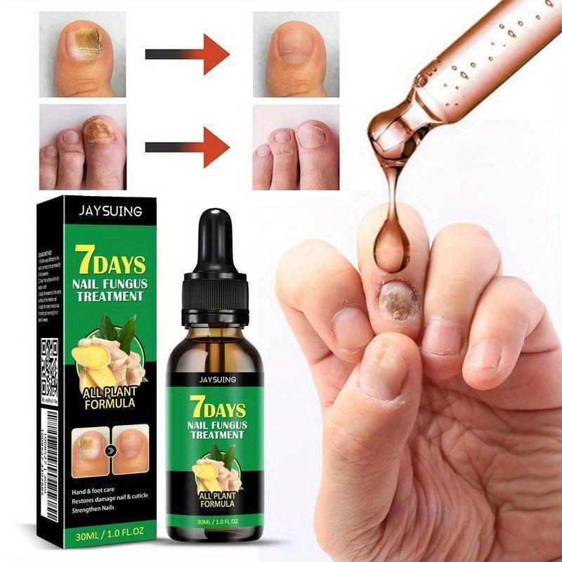 Ginger Nail Treatment Nail,Nail Treatment,Support Nail Care,30ml Ginger Nail Serum,Ginger Cuticle Care Oil For Nails,Ginger Nail Growth Serum Repair and Strengthen.