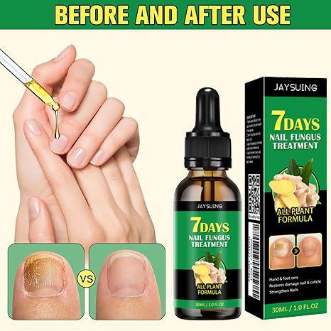 [3 Packs $6.99] JAYSUING Ginger Nail Strengthener Oil, Moisturizes and Thickens Nails -longer, Stronger and Brighter Nails, Nail Care Product