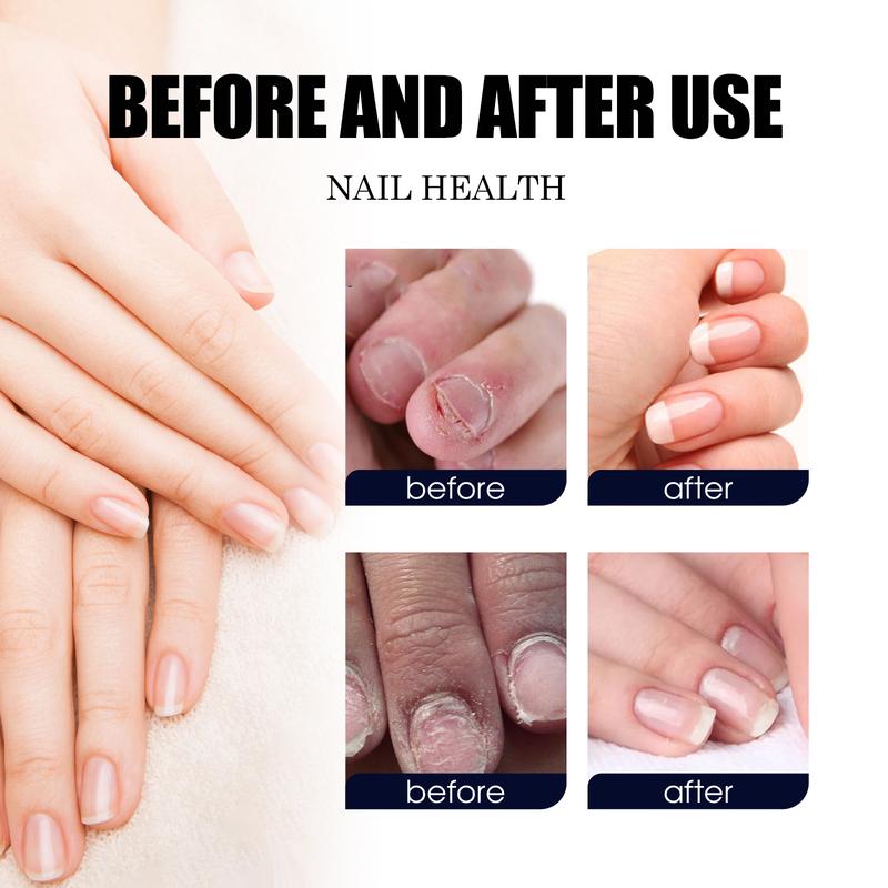 South Moon Nail Care Moisturizer+  Healmuse Fungal Prevention Solution . Nail  support with Basil Leaf Extract, Tea Tree Oil and Lavender Oils for nail fungus prevention, manicures . Nail Polish Moisture Antibacterial