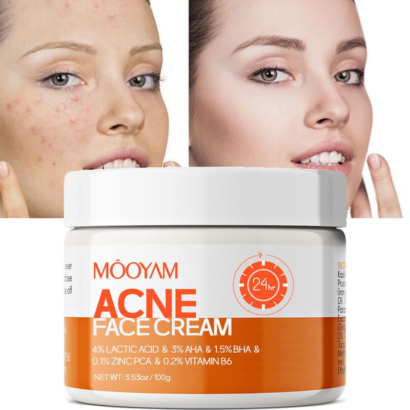 Acne Scar Treatment Cream 100ml Centella & Snail Repair Cream Post-Acne Marks Removal Acne&Pimple Treatment Fragrance Free Paraben Free Skincare Salicylic Skin Repair Sensitive Teens Crema para espinillas Cute skincare products