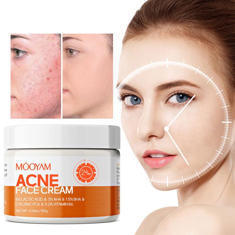 Acne Scar Treatment Cream 100ml Centella & Snail Repair Cream Post-Acne Marks Removal Acne&Pimple Treatment Fragrance Free Paraben Free Skincare Salicylic Skin Repair Sensitive Teens Crema para espinillas Cute skincare products