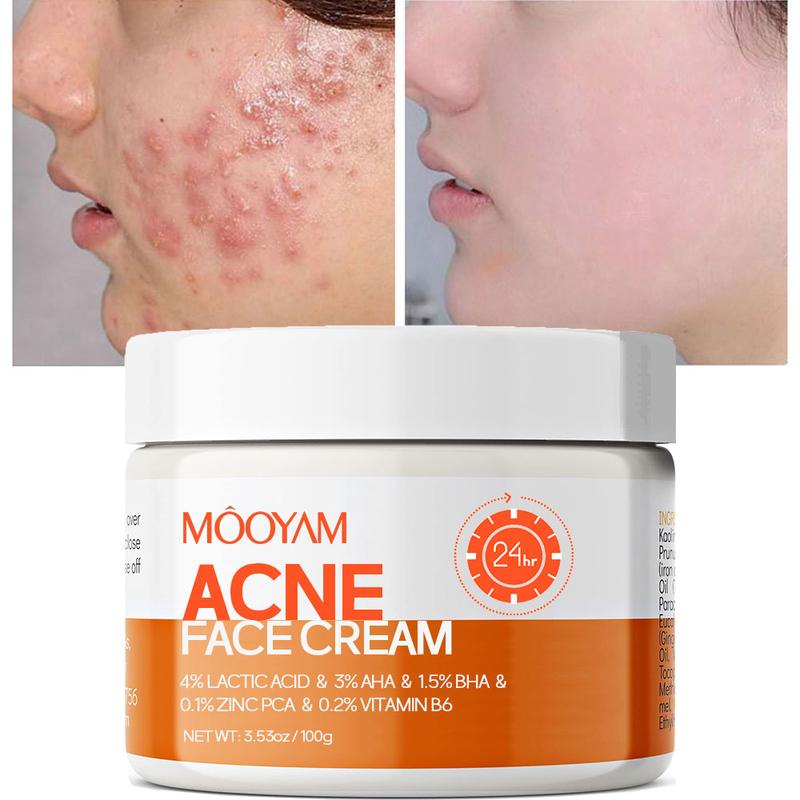 Acne Scar Treatment Cream 100ml Centella & Snail Repair Cream Post-Acne Marks Removal Acne&Pimple Treatment Fragrance Free Paraben Free Skincare Salicylic Skin Repair Sensitive Teens Crema para espinillas Cute skincare products