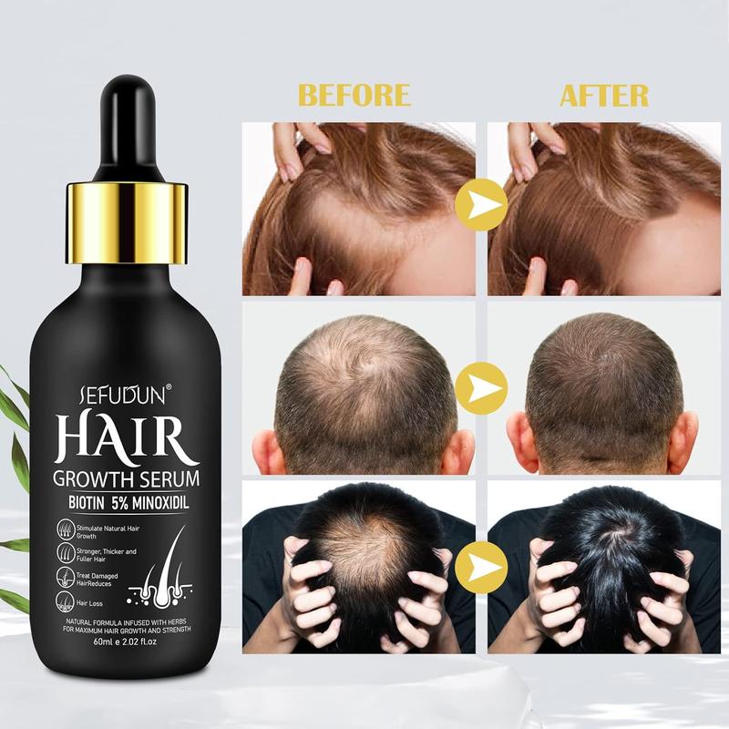 Sefudun - 5% Minoxidil Hair Growth Serum, Minoxidil For Men and Women Hair, 60ml Biotin Hair Regrowth Serum Treatment, Topical Serum for Scalp Hair Care, Getting Thicker Healthier Hair