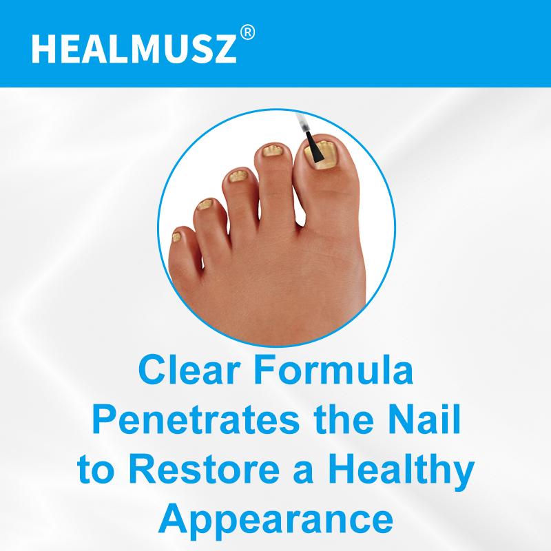 HEALMUSZ Advanced Nail Repair Care Solution: Effective Fungus Prevention and Nail Support Nail Care Lightweight Nail Polish Nail Art Comfort Manicure Propolis Tea Tree