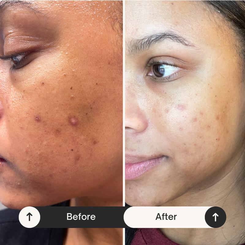 Dark Spot Corrector Serum (NEW AND IMPROVED!) facial serum discoloration serum