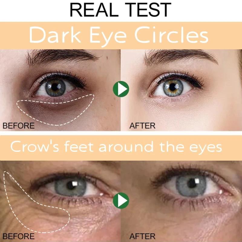 Instant Eye Bag Removal Cream Removal Wrinkles Firming Skin Collagen Fade Fine Lines Brighten Dark Circle Anti Puffiness