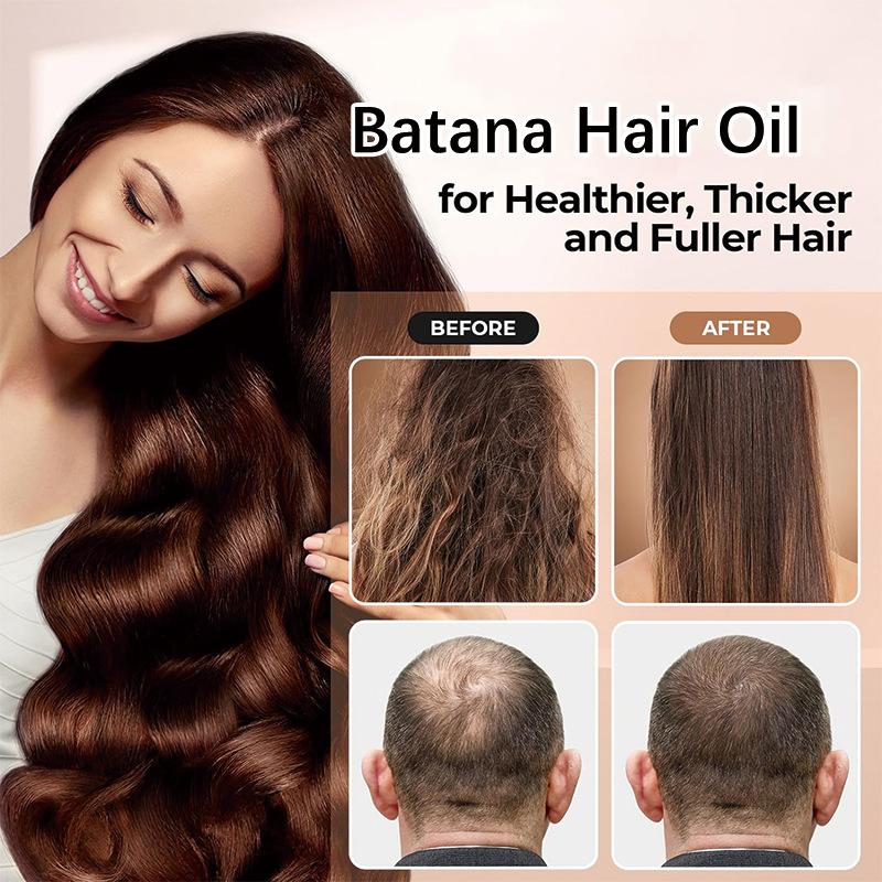 Factory direct sales Supmedoc Raw Batana Oil for HairGrowth from Honduras -Prevent HairLoss & Split Ends for Men & Women -Haircare,Comfort