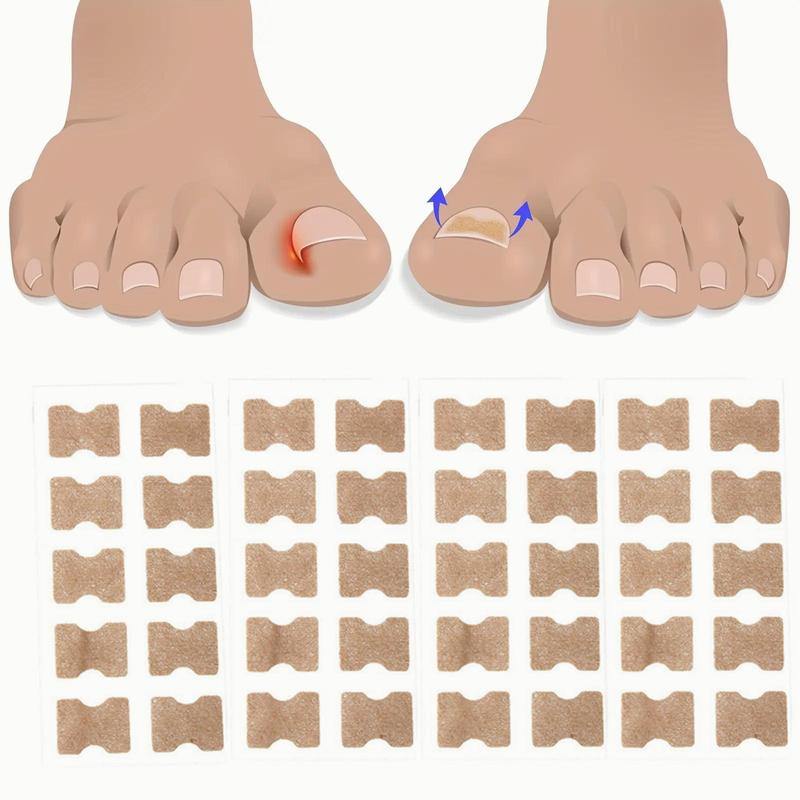 Ingrown Toenail Correction Patch, 30pcs set Breathable Toe Nail Correction Strip, Professional Pedicure Tool for Home & Beauty Salon Use