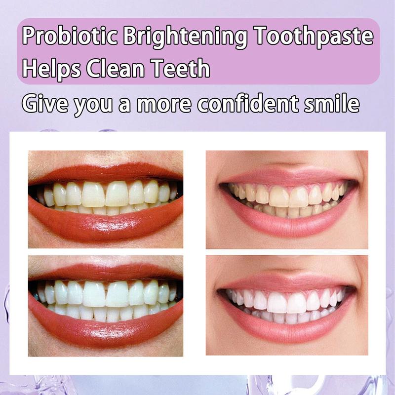 SP-6 Toothpaste Remove smoke stains, Oral Health Management,Fresh Breath,Probiotic Toothpaste for Oral Health Management, with Sodium Saccharin and Lactobacillus,Hydroxyapatite, Whitening Toothpaste Fresh Breath whitening  toothpaste