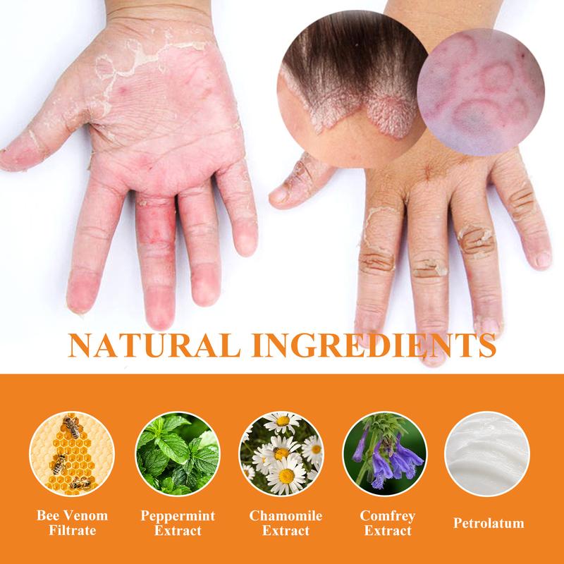 Skin Repair Cream Relieve Itchy Skin Repair Hand and Foot Moss Moisturizing Skin Care Cream