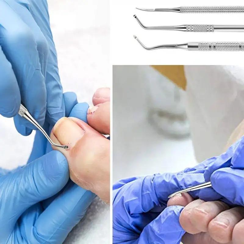 Professional Dual-ended Ingrown Toenail Lifter & Cleaner, 3pcs Stainless Steel Nail Trimmer Double Head Nail Scraper Nail Clippers Toe Fixer Pedicure Nail Tool Set, Nail Art Tool