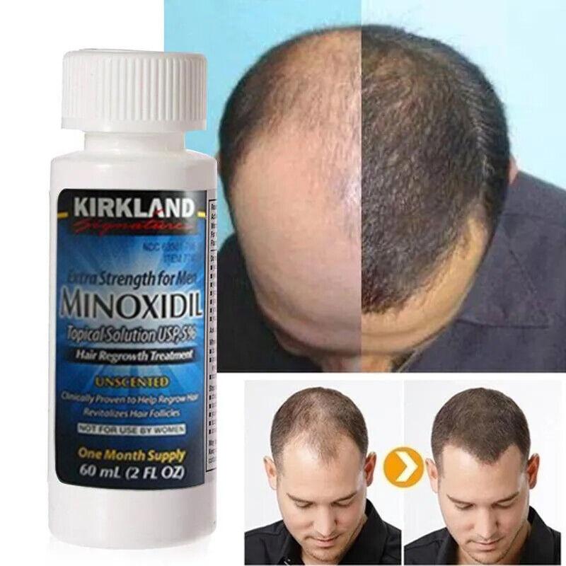 Kirkland Minoxidil 5% Extra Strength 1, 3, 6 Months Supply Men Hair Regrowth Hair Care Daily