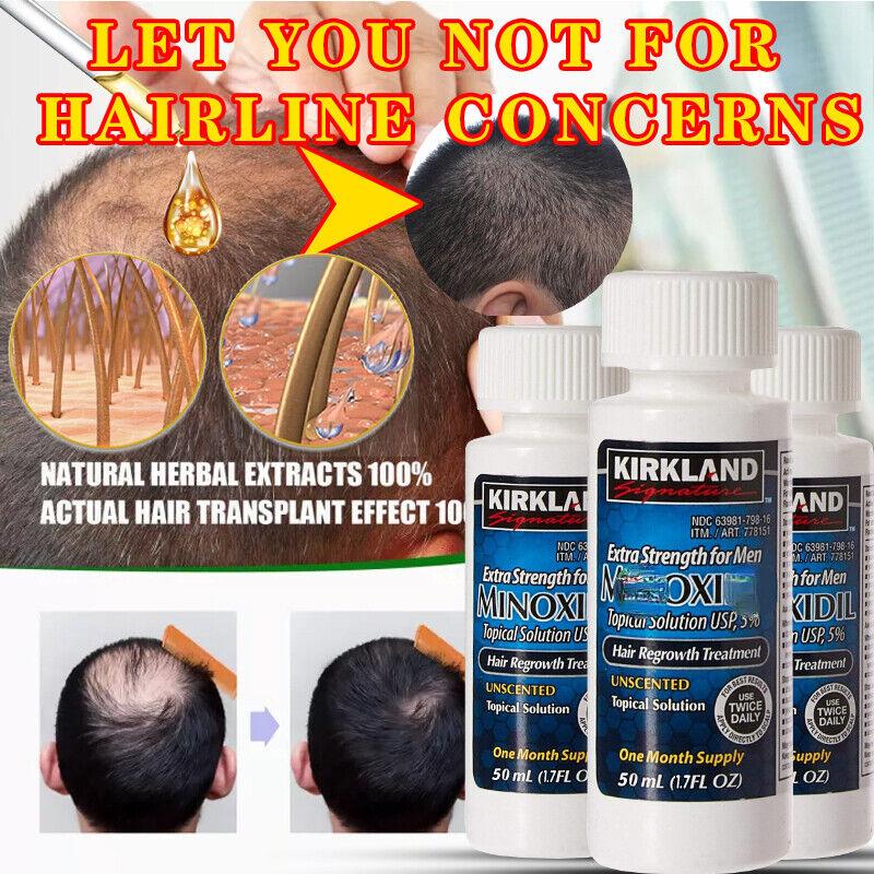 Kirkland Minoxidil 5% Extra Strength 1, 3, 6 Months Supply Men Hair Regrowth Hair Care Daily