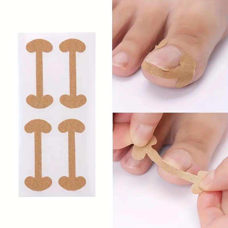 Toenail Correction Patches, 60pcs set Ingrown Nail Correction Sticker, Nail Care Tool for Men & Women, Manicure & Pedicure Tool, Nail Supplies, Christmas Gift