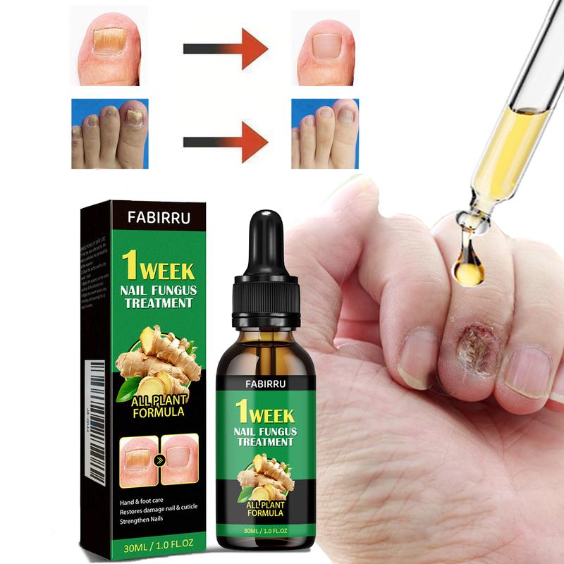 FABIRRU [Quick Seller Christmas 70% off] Ginger Nail Treatment Nail Support Nail Care,Multi-Purpose Nail Repair, Nail Solution for Discolored and Damaged Nails