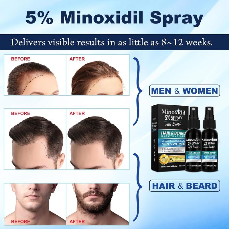 5% Minoxidil Spray for Hair and Beard Growth, Minoxidil for Men Hair, Minoxidil for Women Hair Growth, Minoxidil 5 Percent Hair Regrowth for Men, Hair Serum for Hair Growth 2PCS