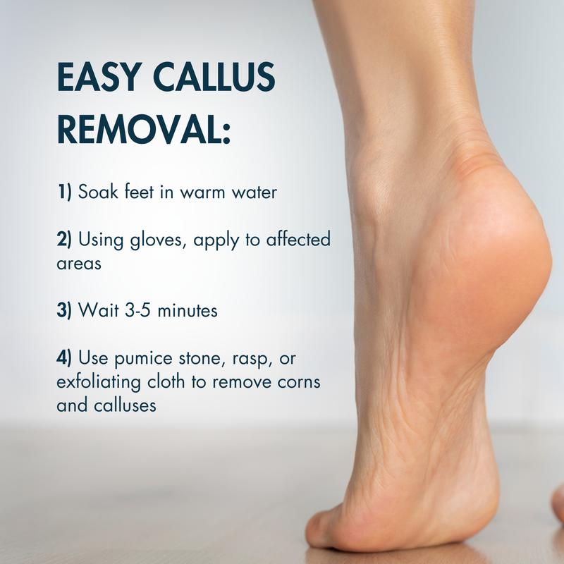 DeEnti Callus Remover Gel, Extra Strength Foot Callus Remover, 8oz Home Pedicure Supplies for Rough, Dry, Cracked Skin, Callus Remover for Feet