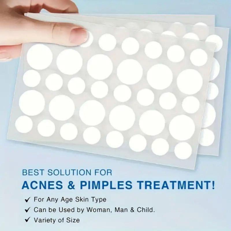 Hydrocolloid Acne Patches, 540pcs set Acne Cover Patch, Facial Skin Care Product for Women & Men, Daily Skincare Product for Acne Prone Skin