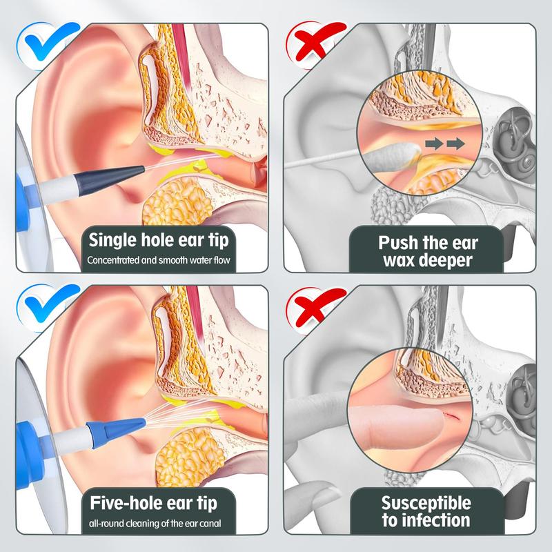 Manual Ear Irrigation Flushing System, 1 Set Earwax Removal Kit, Ear Cleaner System for Adults & Kids, Include Full Set Of Cleaning Tools, Ear Wax Remover, Ear Wax Flush Kit, Body Care Products Set, Christmas Gift