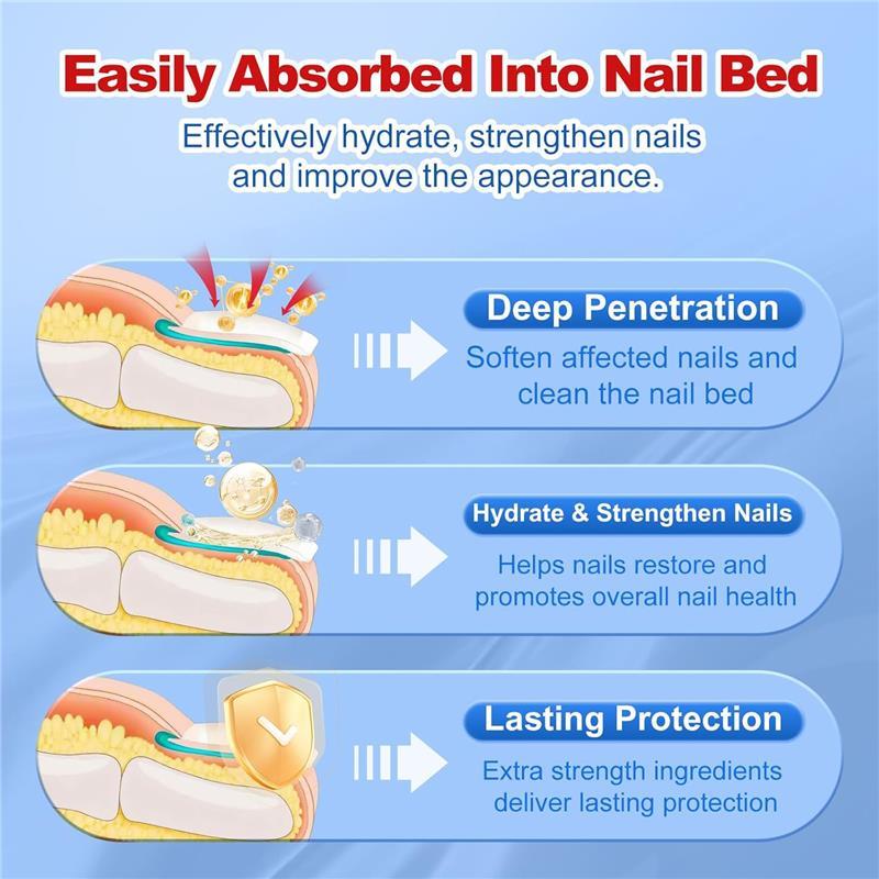 Toenail Fungus Treatment, Extra Strength Nail Toenail Fungus Remover, Toe Fingernail Repair Liquid Solution Fast Acting for Woman and Man - 30mL(1 fl oz)