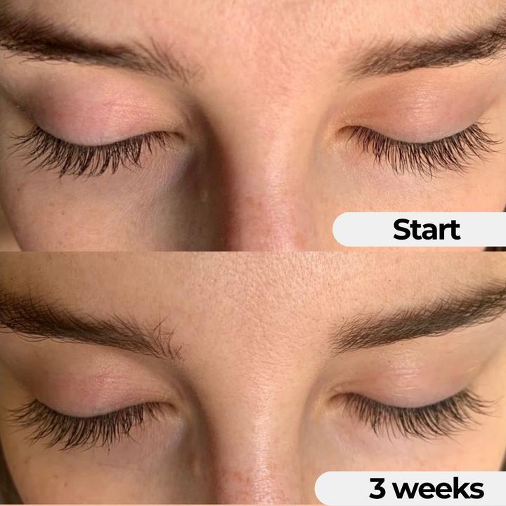 Eyelash Growth Serum 8ML to Grow Thicker, Longer Lashes, Developed by Anti-Aging Scientists, Clean Formulation, No Prostaglandins, 8ML, Skin Care