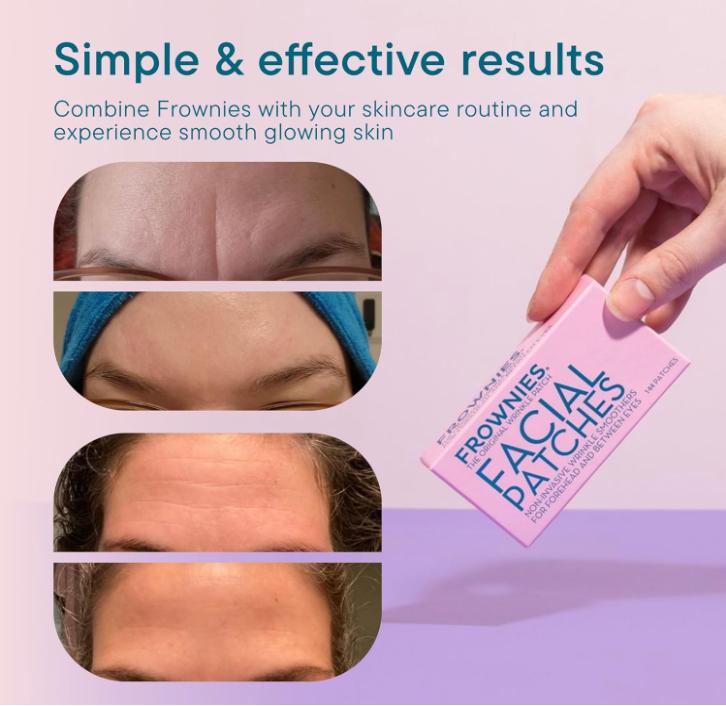 Pd Frownies Forehead and Between the Eyes Wrinkle Patches - Hypoallergenic Facial Patches to Smooth & Soften Forehead Wrinkles & Eleven Lines - For Overnight Use, 144 Patches