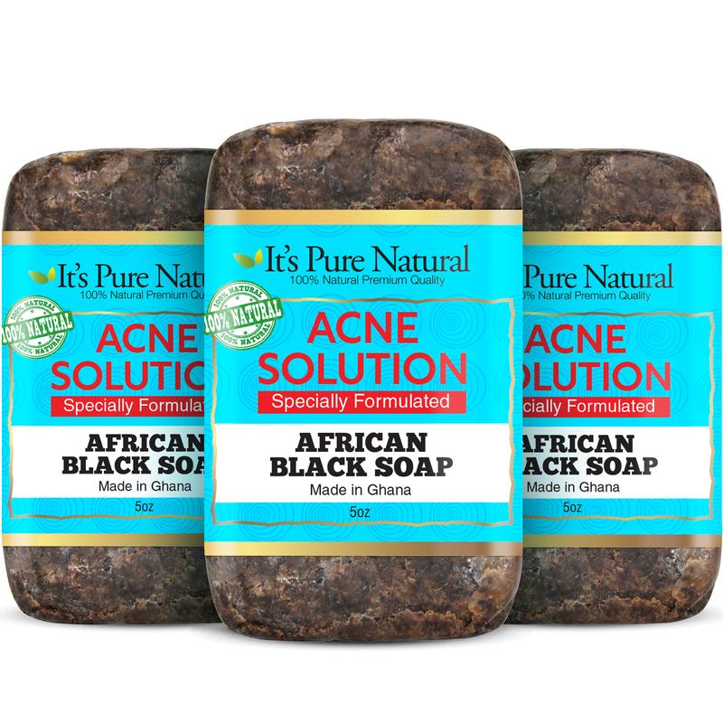 It's Pure Natural African Black Soap Bars with Acne Solution (Pack of 3) Organic Raw Soap for Face & Body Body Care Body Wash